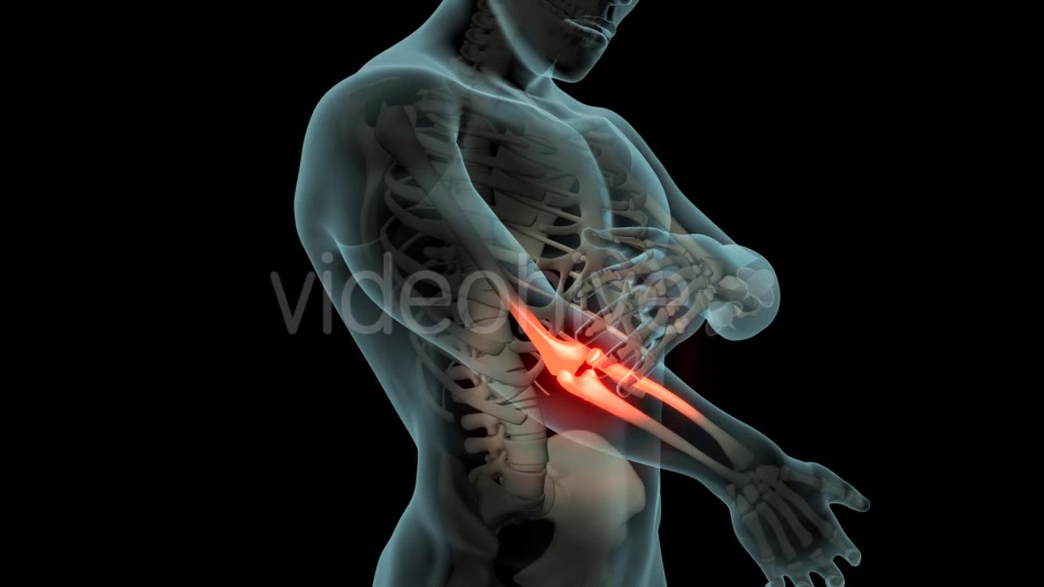 Elbow Pain Videohive 21253430 Motion Graphics Image 7
