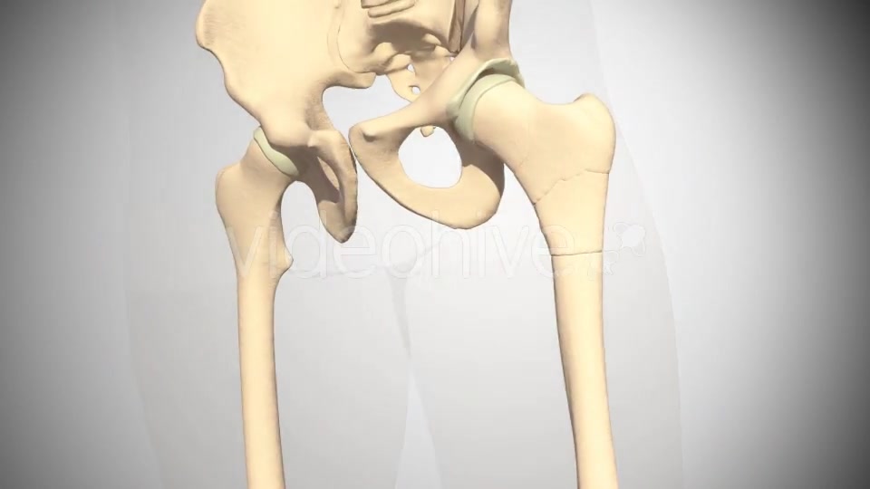 Fracture Femur Videohive 14920493 Motion Graphics Image 3