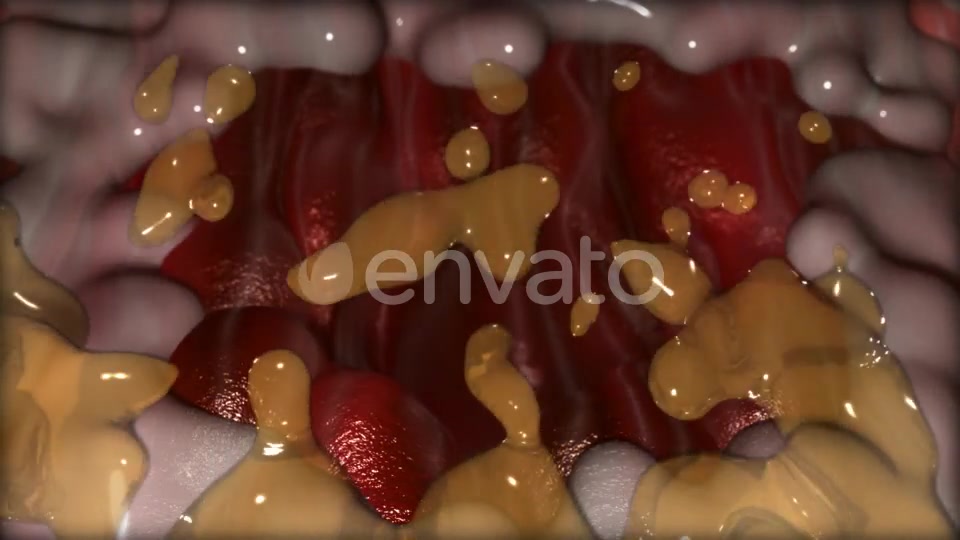 Gastric Ulcer Disease Videohive 21842950 Motion Graphics Image 10