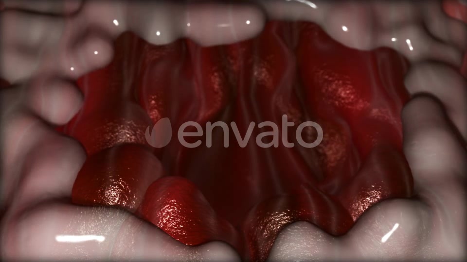 Gastric Ulcer Disease Videohive 21842950 Motion Graphics Image 11