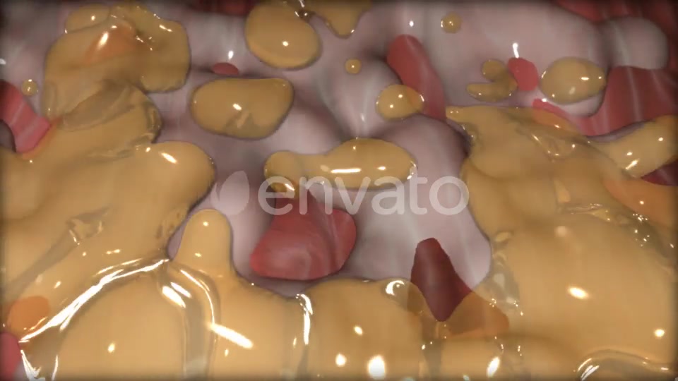 Gastric Ulcer Disease Videohive 21842950 Motion Graphics Image 5