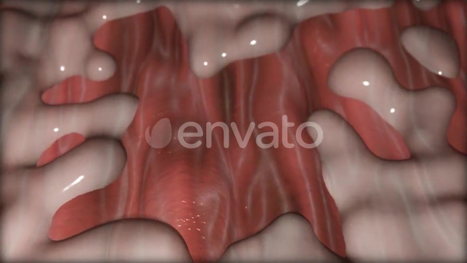 Gastric Ulcer Disease Videohive 21842950 Motion Graphics Image 6