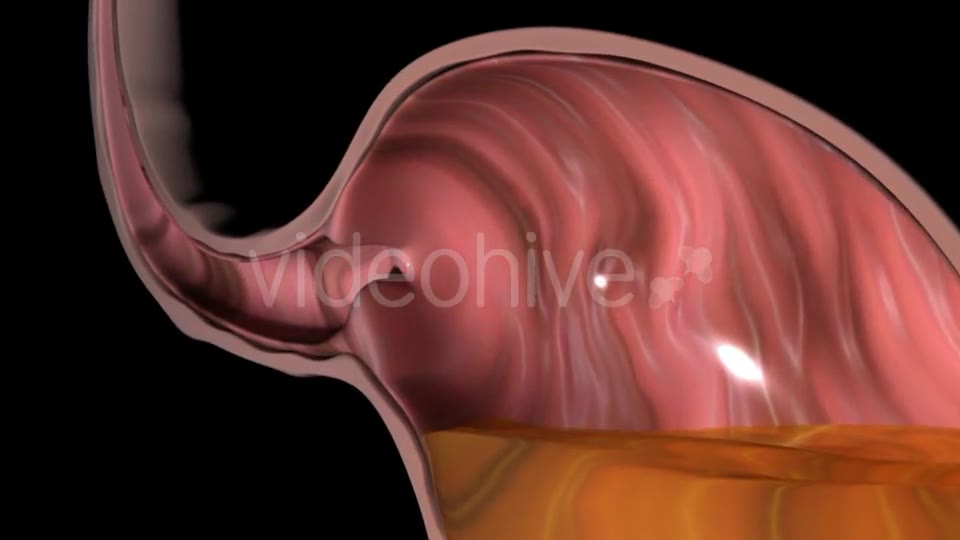 Gastroesophageal Reflux Videohive 20618472 Motion Graphics Image 2