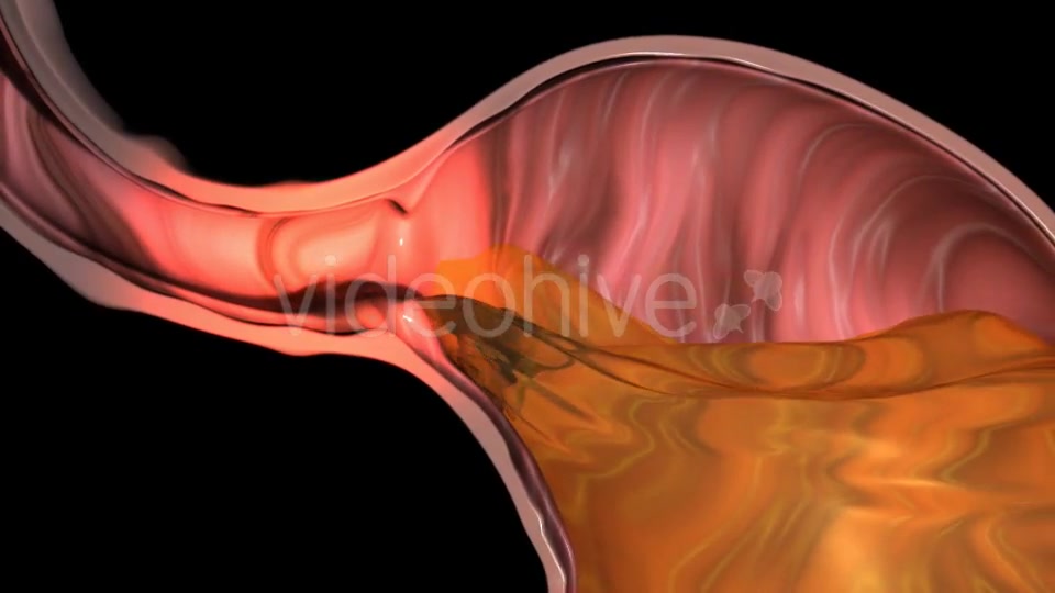 Gastroesophageal Reflux Videohive 20618472 Motion Graphics Image 7