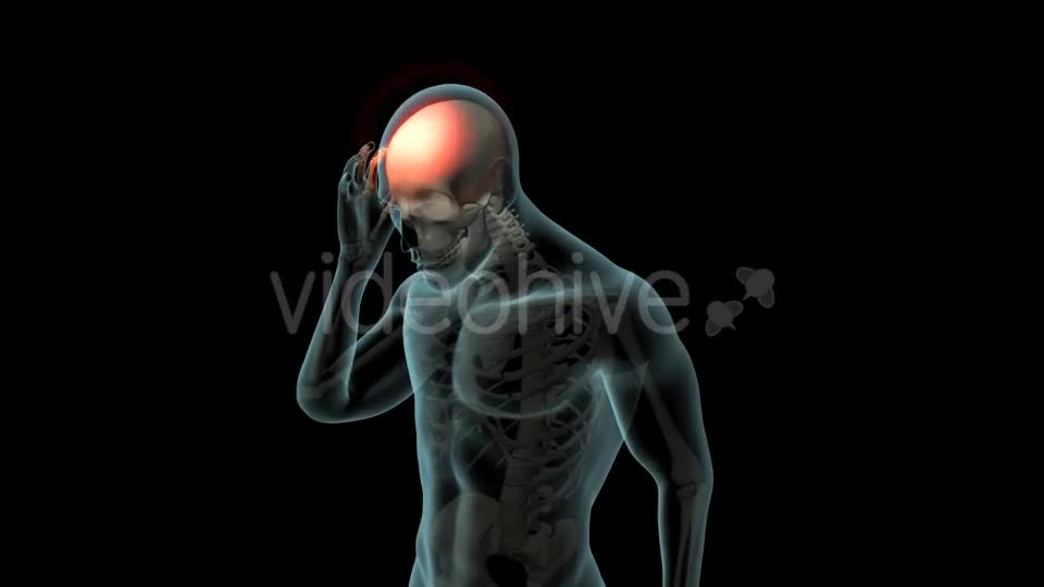 Head Pain Videohive 21250652 Motion Graphics Image 1