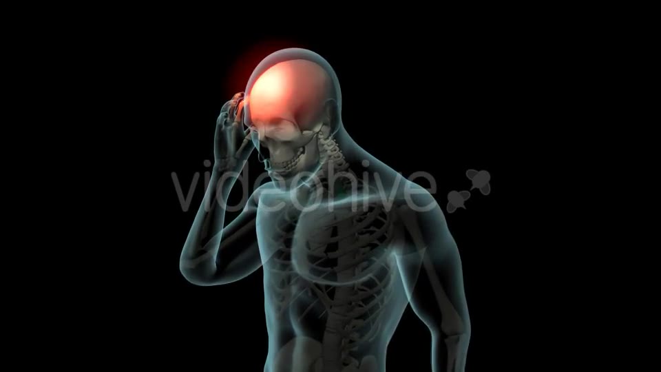 Head Pain Videohive 21250652 Motion Graphics Image 2