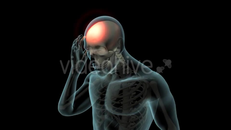 Head Pain Videohive 21250652 Motion Graphics Image 3