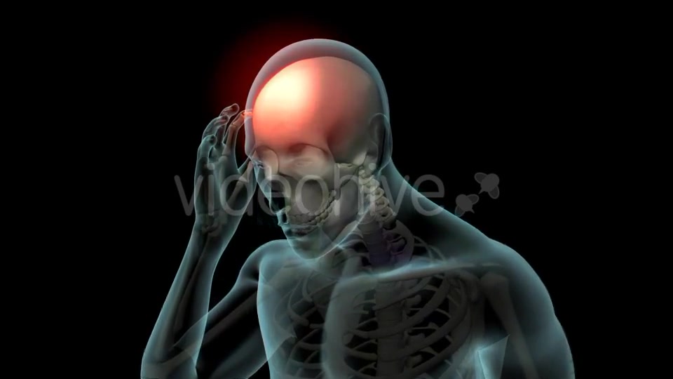 Head Pain Videohive 21250652 Motion Graphics Image 4