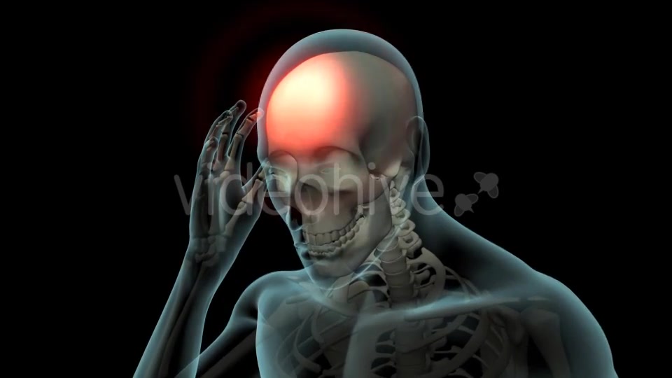 Head Pain Videohive 21250652 Motion Graphics Image 5
