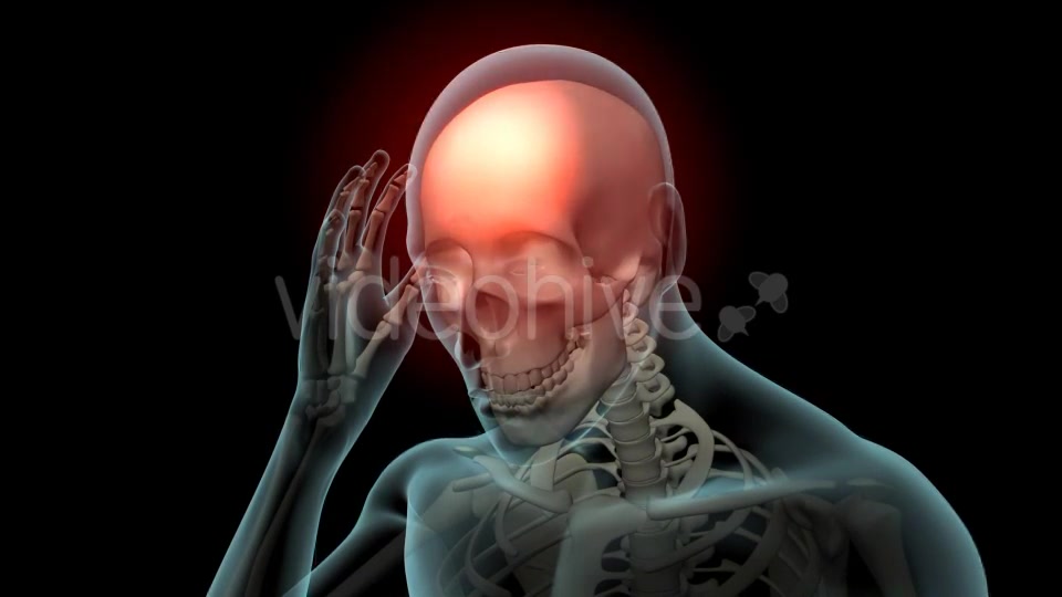 Head Pain Videohive 21250652 Motion Graphics Image 6