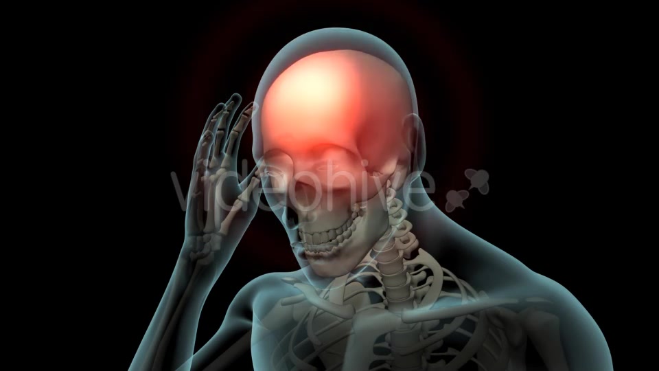 Head Pain Videohive 21250652 Motion Graphics Image 7