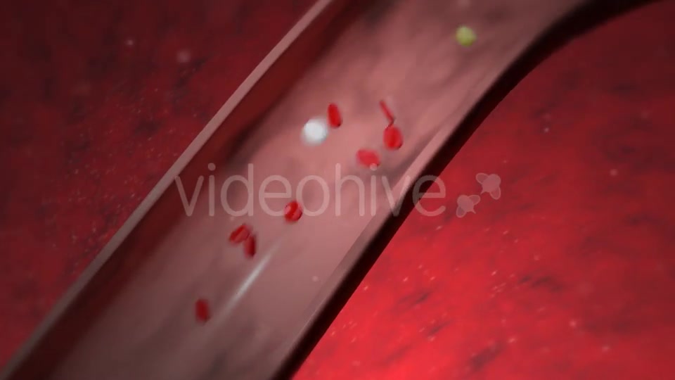 Heart Attack Videohive 20667465 Motion Graphics Image 4