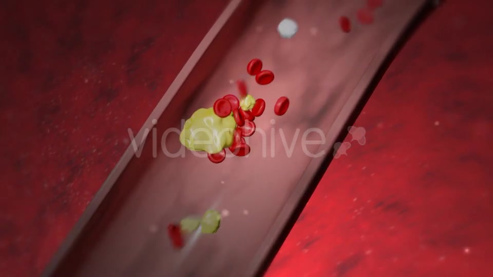 Heart Attack Videohive 20667465 Motion Graphics Image 5