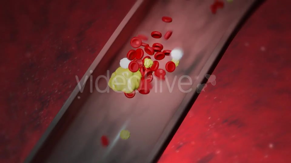 Heart Attack Videohive 20667465 Motion Graphics Image 6