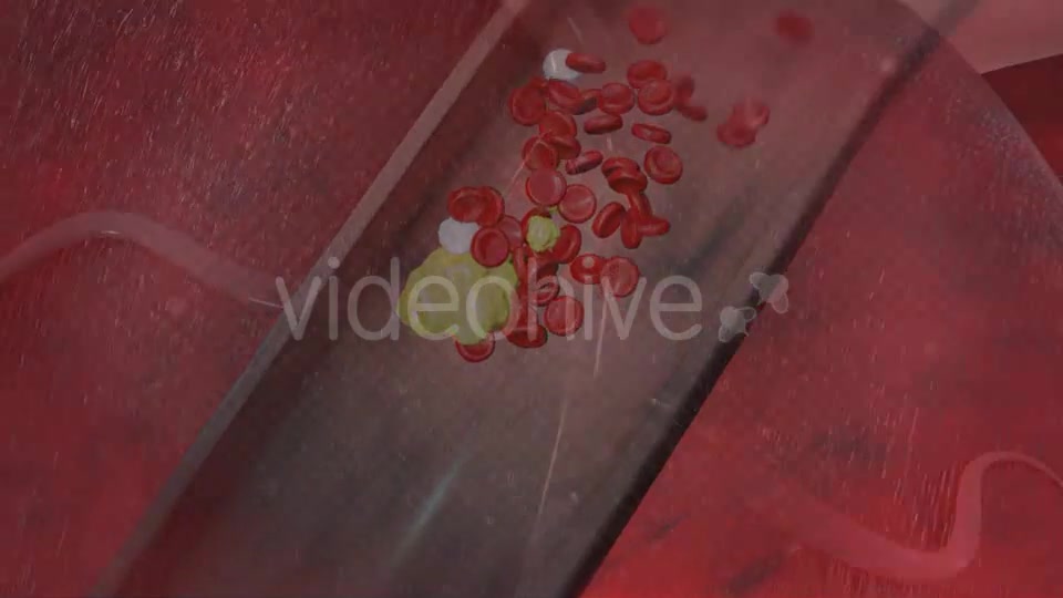 Heart Attack Videohive 20667465 Motion Graphics Image 7
