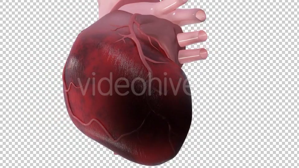 Heart Attack Videohive 20667465 Motion Graphics Image 8