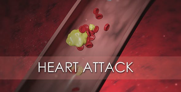 Heart Attack - Download Videohive 20667465