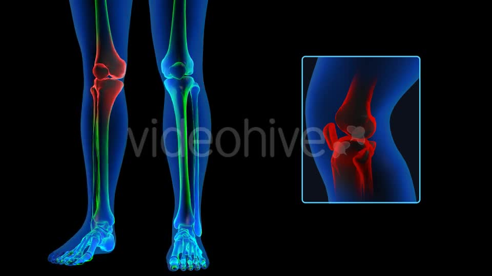 Human Body Knee Pain Videohive 19102255 Motion Graphics Image 1
