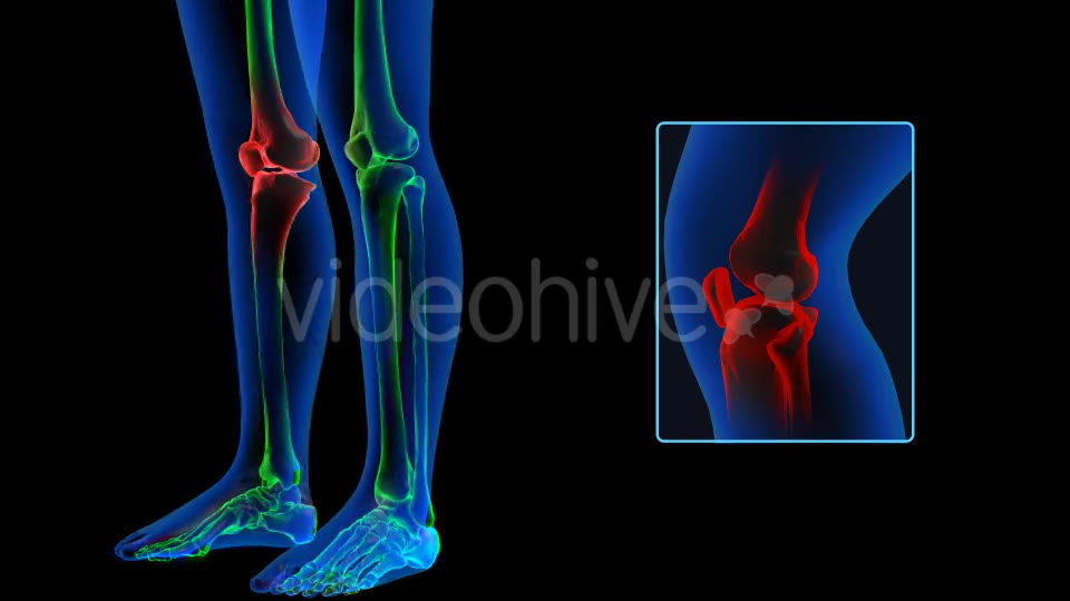 Human Body Knee Pain Videohive 19102255 Motion Graphics Image 2