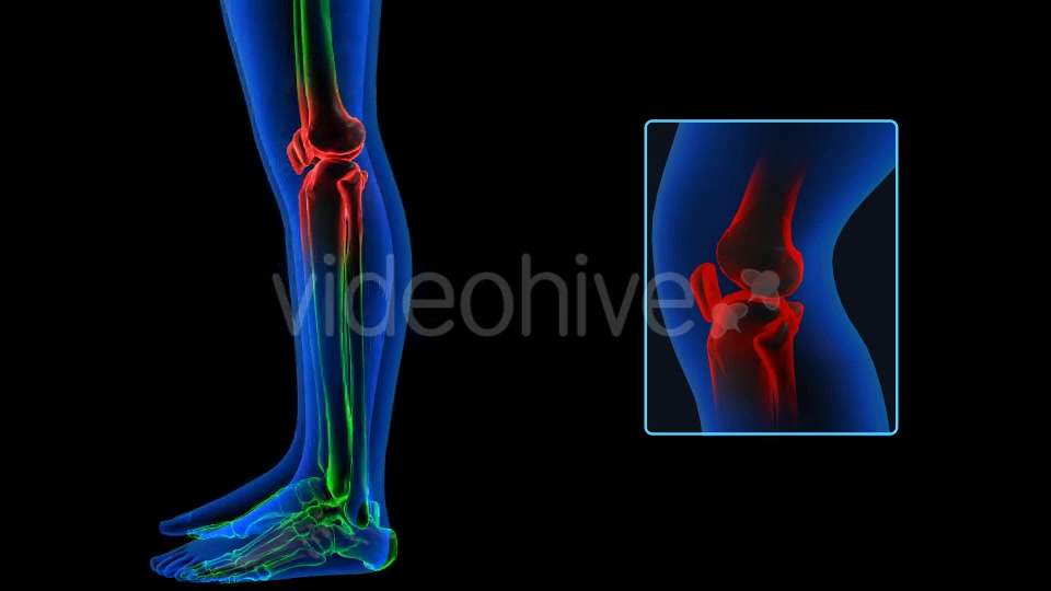 Human Body Knee Pain Videohive 19102255 Motion Graphics Image 3