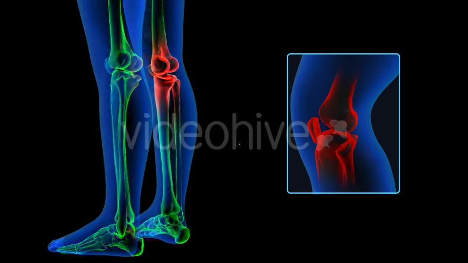 Human Body Knee Pain Videohive 19102255 Motion Graphics Image 4