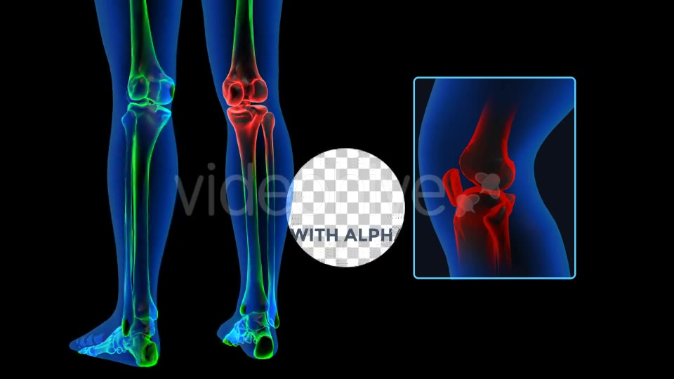 Human Body Knee Pain Videohive 19102255 Motion Graphics Image 5
