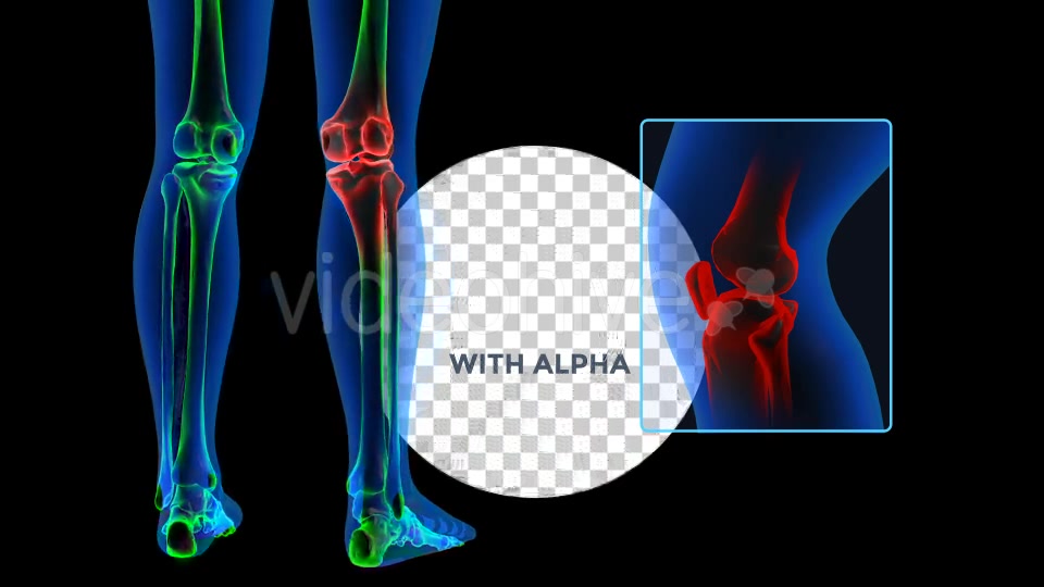 Human Body Knee Pain Videohive 19102255 Motion Graphics Image 6