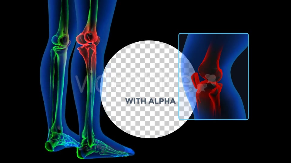 Human Body Knee Pain Videohive 19102255 Motion Graphics Image 7
