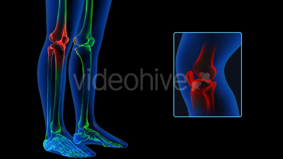 Human Body Knee Pain Videohive 19102255 Motion Graphics Image 9