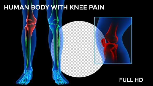 Human Body Knee Pain FullHD - 19222441 Videohive Download