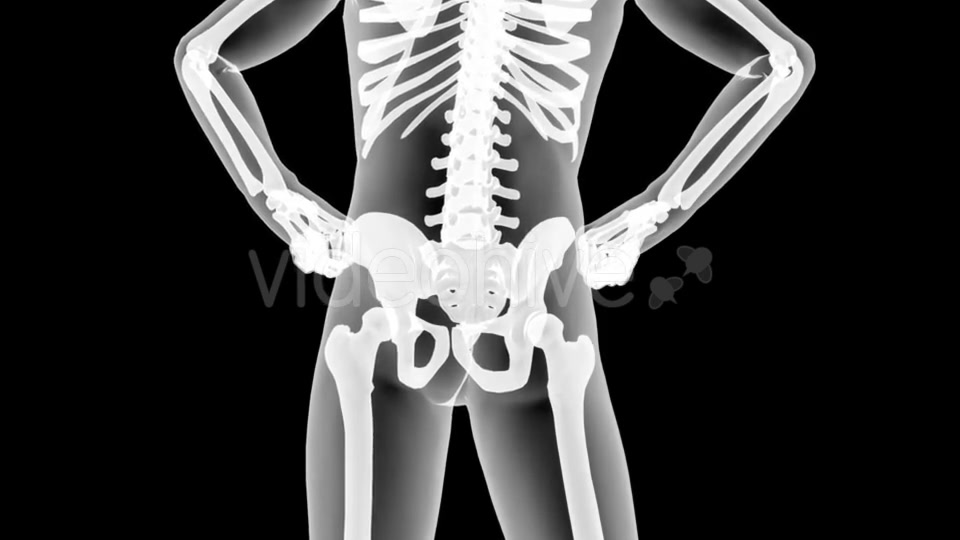 Human Bones Radiographic Scan Videohive 19056600 Motion Graphics Image 10