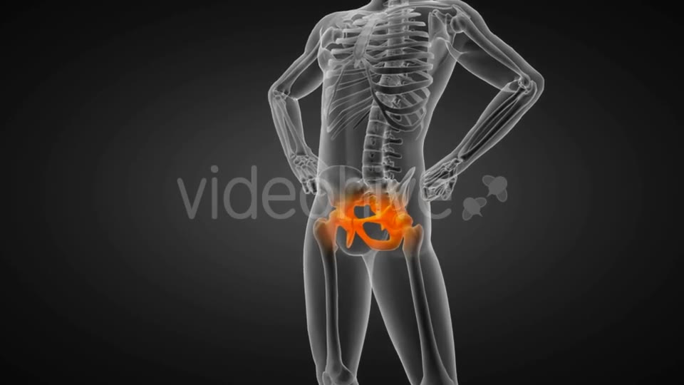 Human Bones Radiographic Scan Videohive 19056600 Motion Graphics Image 2