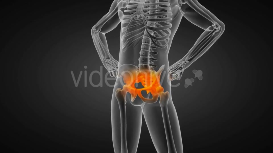Human Bones Radiographic Scan Videohive 19056600 Motion Graphics Image 3