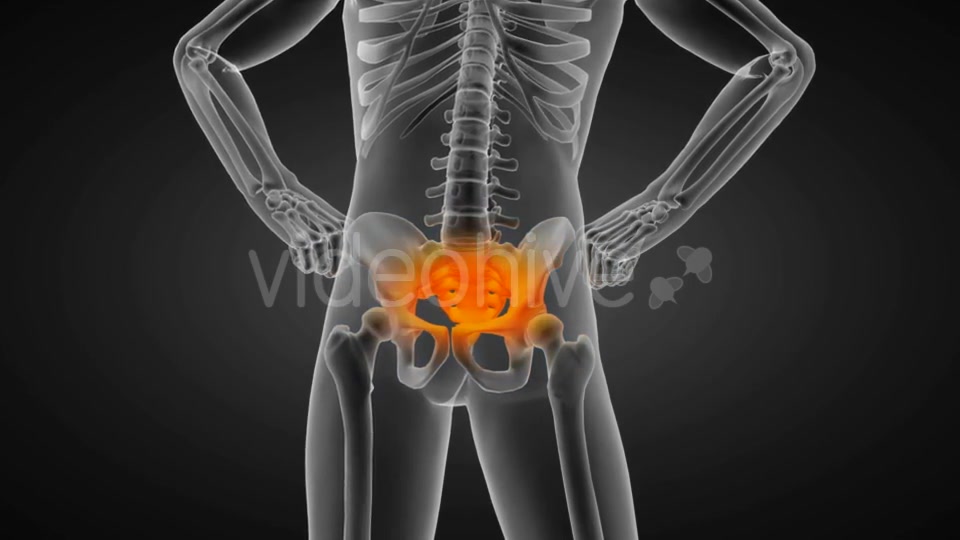 Human Bones Radiographic Scan Videohive 19056600 Motion Graphics Image 5