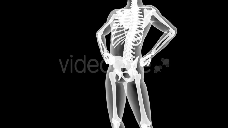 Human Bones Radiographic Scan Videohive 19056600 Motion Graphics Image 6