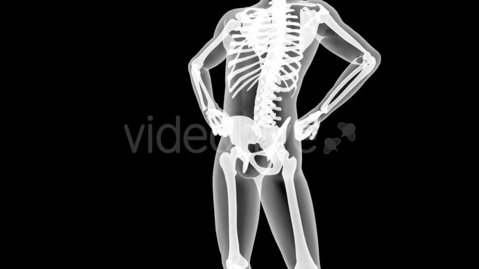 Human Bones Radiographic Scan Videohive 19056600 Motion Graphics Image 7