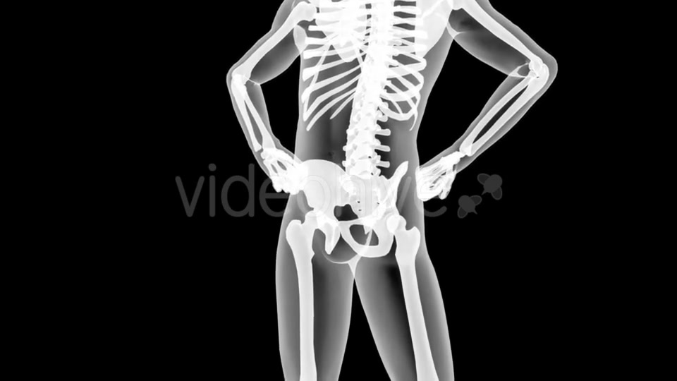 Human Bones Radiographic Scan Videohive 19056600 Motion Graphics Image 8
