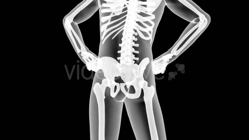 Human Bones Radiographic Scan Videohive 19056600 Motion Graphics Image 9