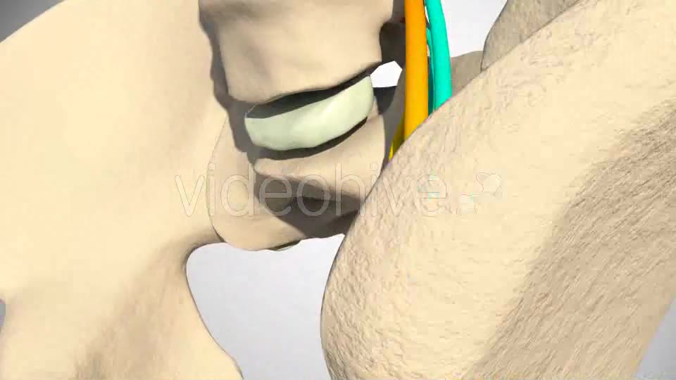 Inflammation Of The Sciatic Nerve Videohive 14504287 Motion Graphics Image 10