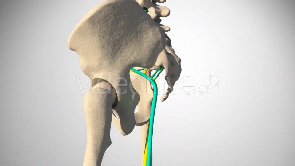 Inflammation Of The Sciatic Nerve Videohive 14504287 Motion Graphics Image 11