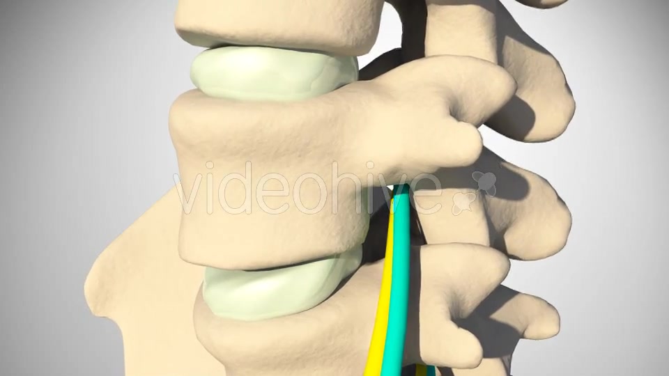 Inflammation Of The Sciatic Nerve Videohive 14504287 Motion Graphics Image 5