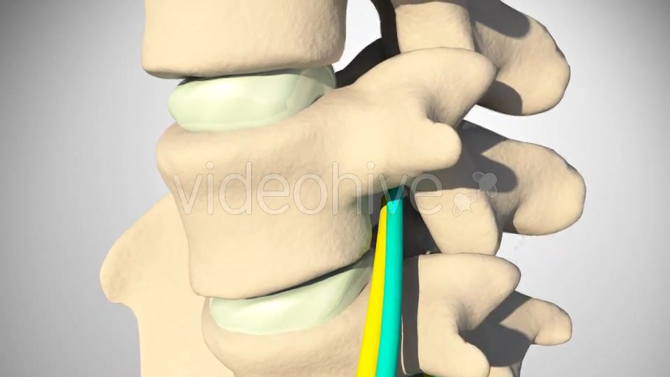 Inflammation Of The Sciatic Nerve Videohive 14504287 Motion Graphics Image 6