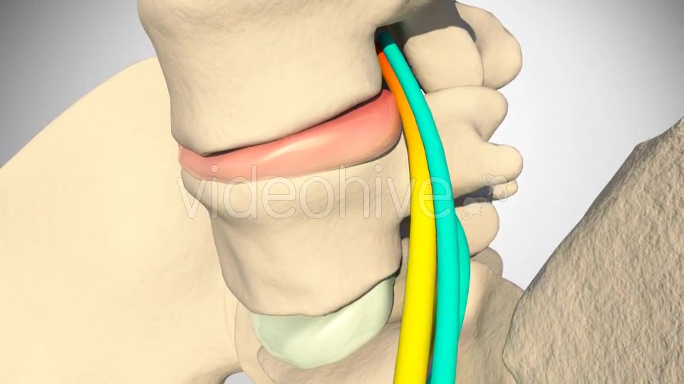 Inflammation Of The Sciatic Nerve Videohive 14504287 Motion Graphics Image 8