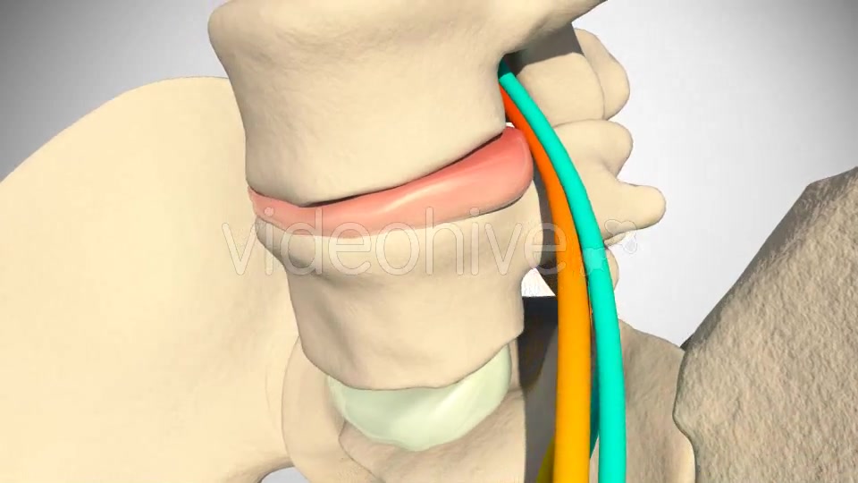 Inflammation Of The Sciatic Nerve Videohive 14504287 Motion Graphics Image 9