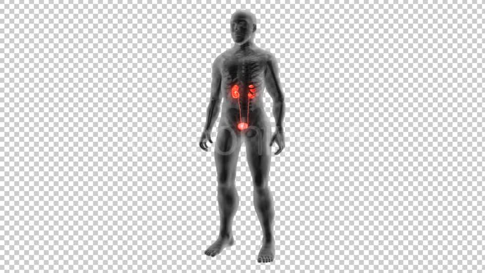Kidney Stones Animation Videohive 19962852 Motion Graphics Image 1