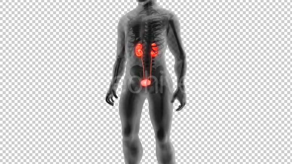 Kidney Stones Animation Videohive 19962852 Motion Graphics Image 2