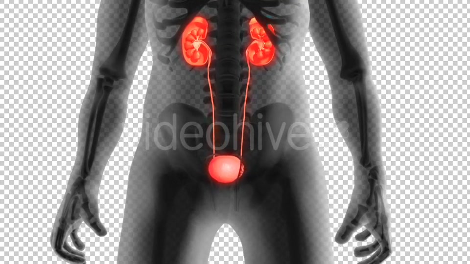 Kidney Stones Animation Videohive 19962852 Motion Graphics Image 3