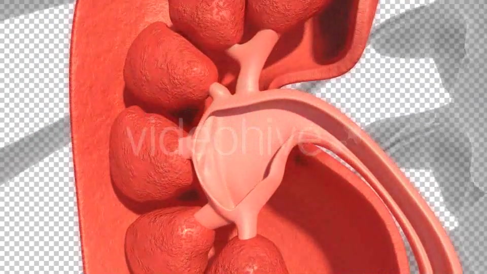Kidney Stones Animation Videohive 19962852 Motion Graphics Image 4