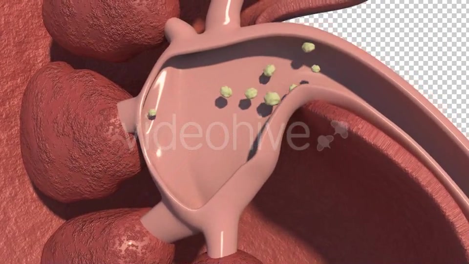 Kidney Stones Animation Videohive 19962852 Motion Graphics Image 5
