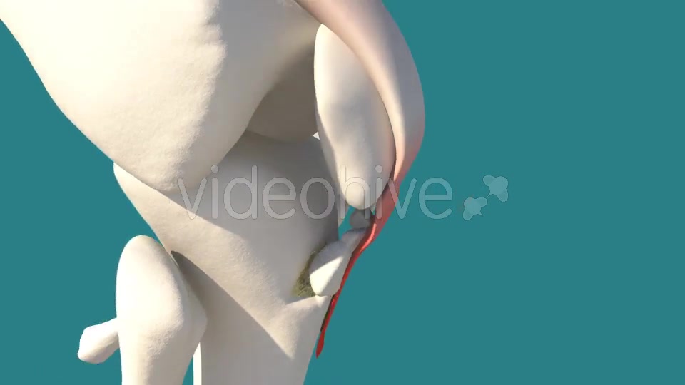 Knee Injury Videohive 14399323 Motion Graphics Image 10